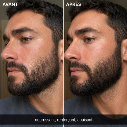 SERUM HYDRA BARBE