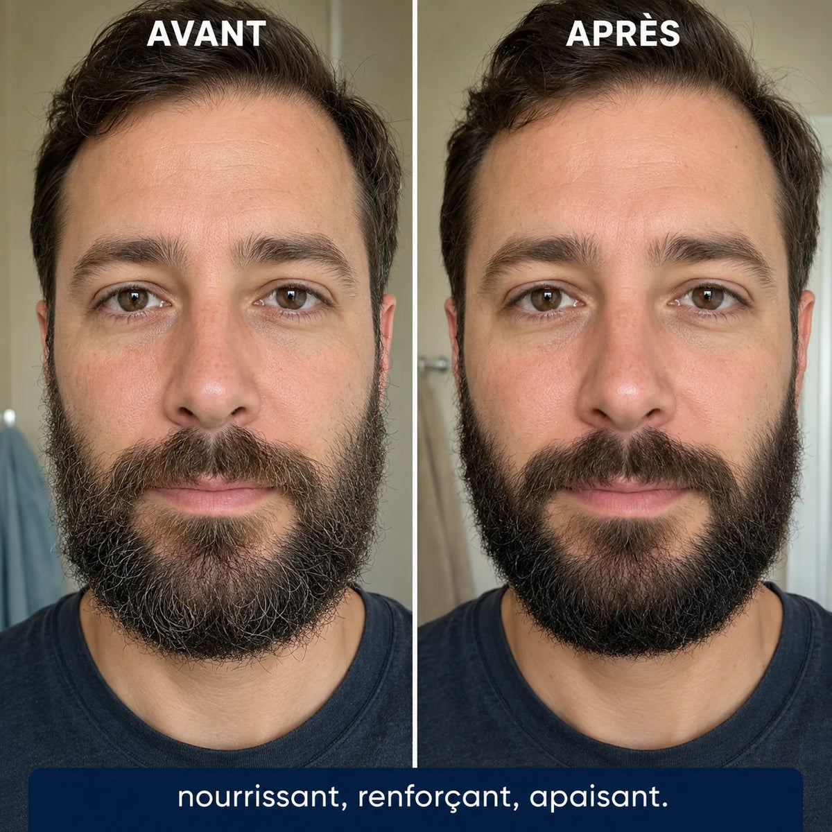 SERUM HYDRA BARBE